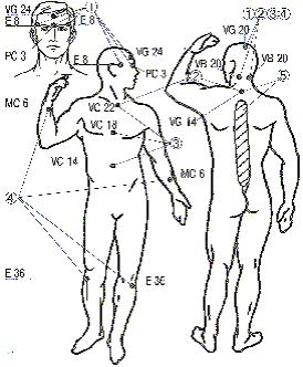 肩こり・腰痛バイオコレクターのツボと症状